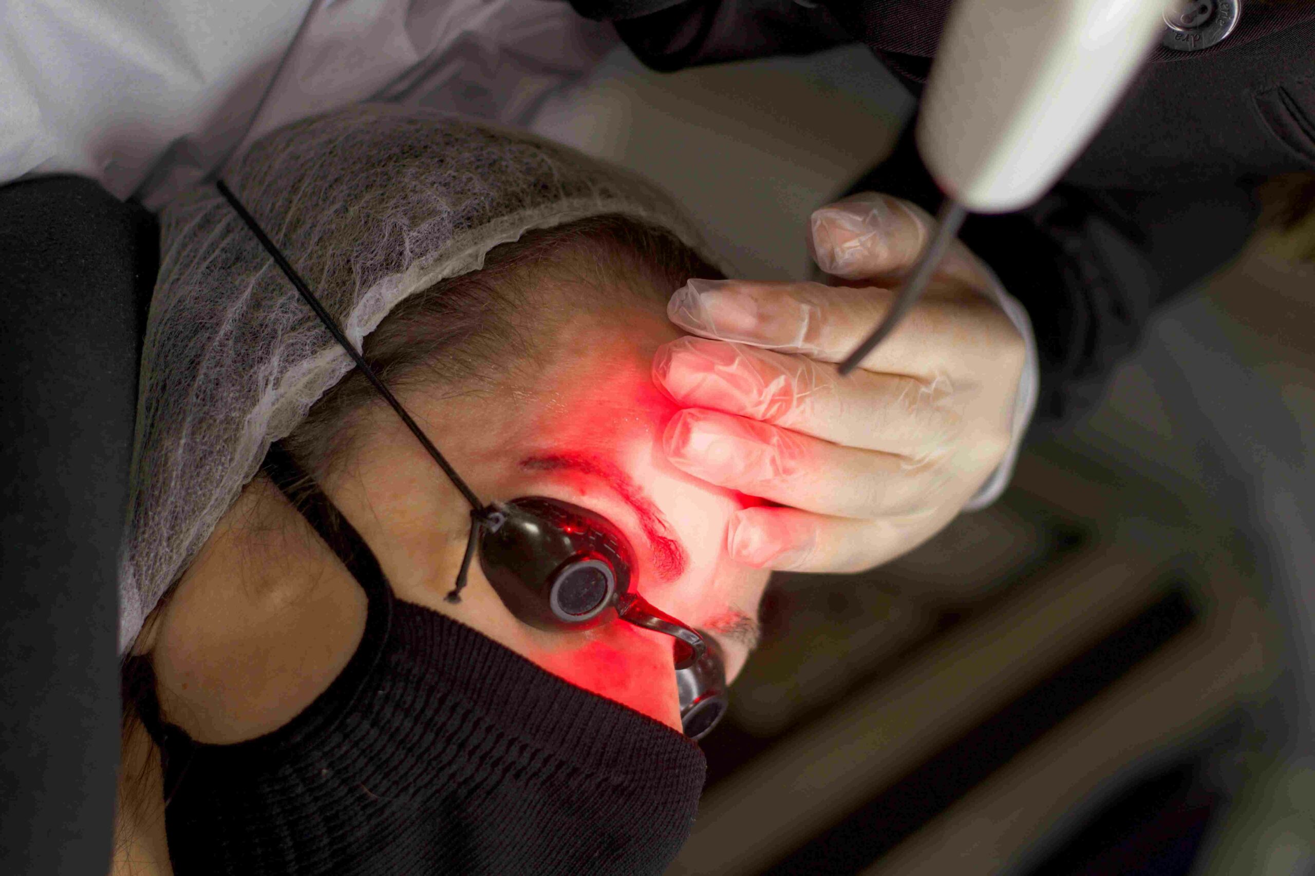 laser terapia